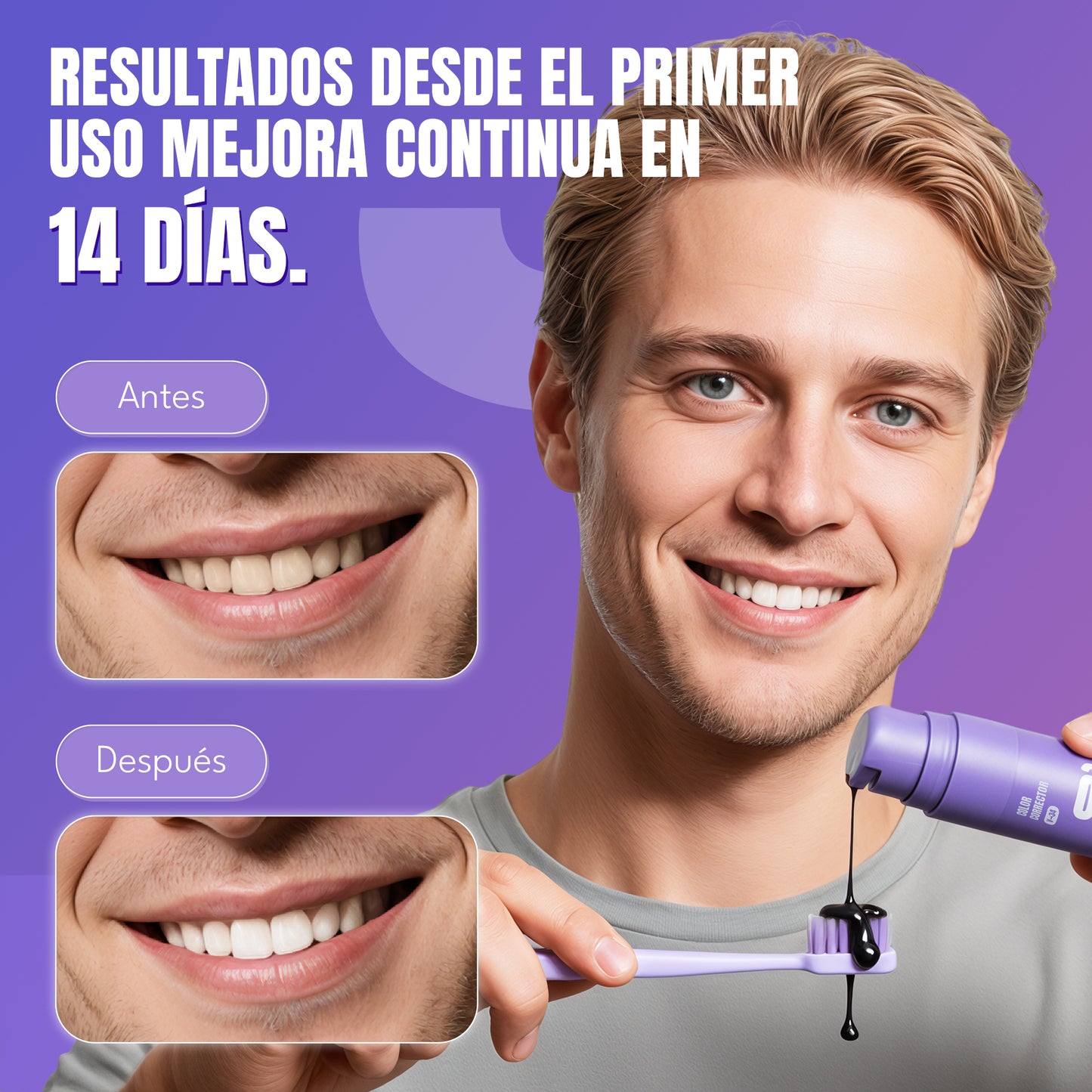 Blanqueador Dental V34 Whitebro – 60ml